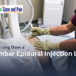 How Long Does a Lumbar Epidural Injection Last?
