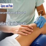 Is Transforaminal Epidural Better Than Regular Epidural?