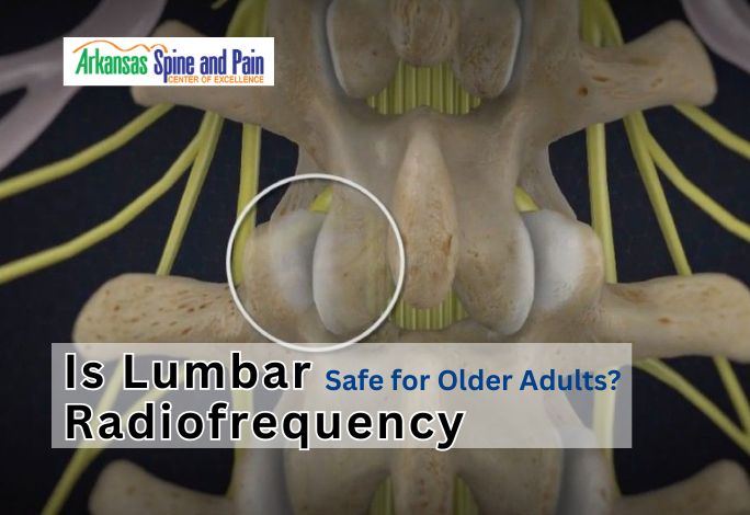 Discover why Lumbar Radiofrequency Ablation is a safe, minimally invasive alternative to surgery for older adults seeking long-term relief from arthritis pain.