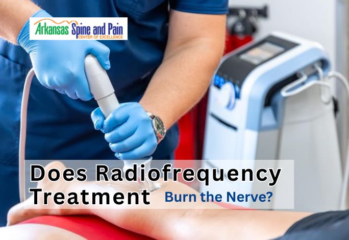 Worried about "burning" nerves? Learn how Radiofrequency Ablation uses controlled heat to safely block pain signals without permanent damage or surgery.