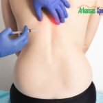 What You Need To Know About Pain Management Injections