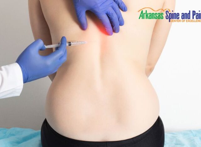 What You Need To Know About Pain Management Injections