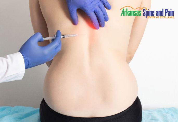 What You Need To Know About Pain Management Injections