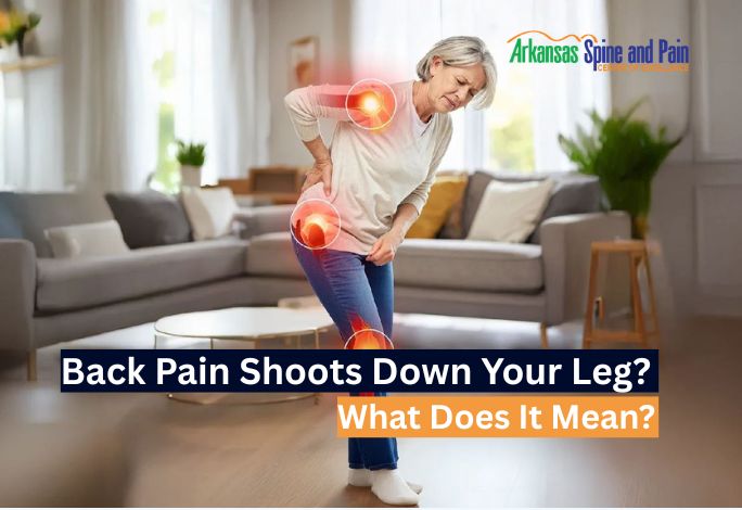 What Does It Mean When Back Pain Shoots Down Your Leg?