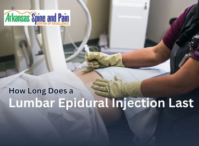 How Long Does a Lumbar Epidural Injection Last?