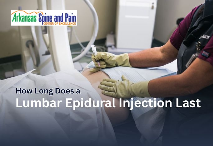 How Long Does a Lumbar Epidural Injection Last?