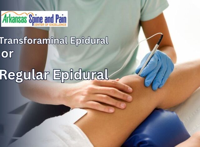Is Transforaminal Epidural Better Than Regular Epidural?