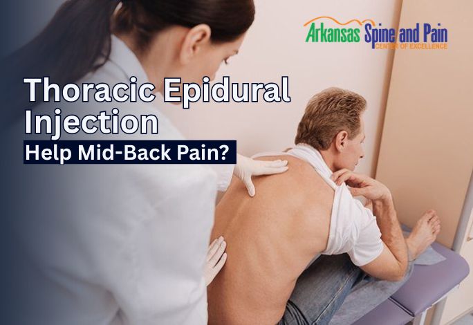 Can a Thoracic Epidural Injection Help Mid-Back Pain?