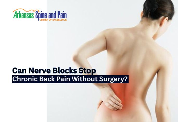 Explore how nerve blocks work to interrupt the pain cycle. Learn about the types of injections available and if you are a candidate for this non-surgical treatment.