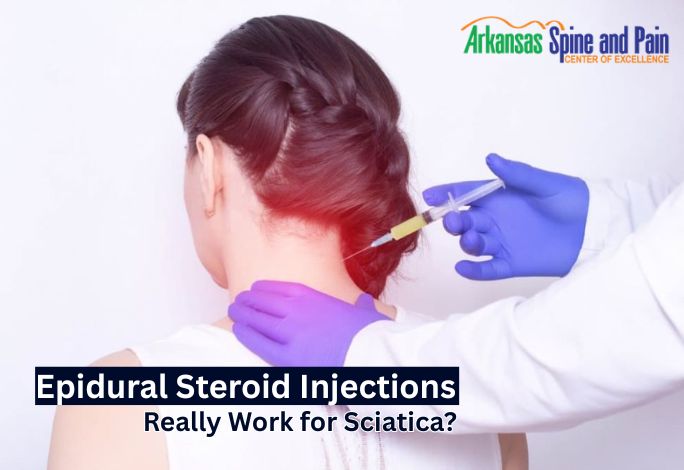 The steroid helps reduce inflammation, while the anesthetic provides temporary pain relief. By addressing nerve irritation at the source,