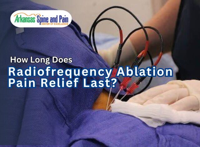 Most patients enjoy 6 to 18 months of relief with Radiofrequency Ablation. Learn why RFA lasts longer than injections and what to expect during recovery.