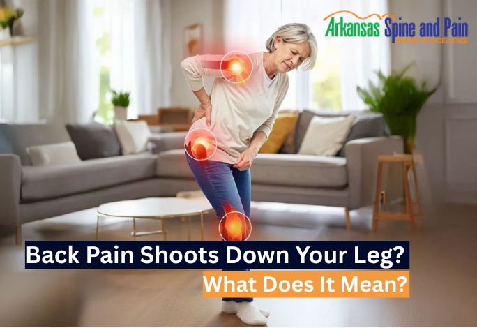 What Does It Mean When Back Pain Shoots Down Your Leg?