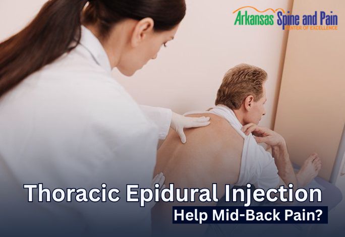 Can a Thoracic Epidural Injection Help Mid-Back Pain?
