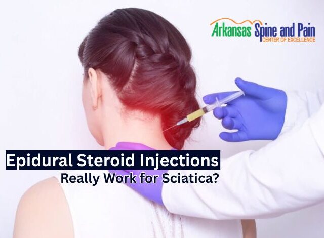 Do Epidural Steroid Injections Really Work for Sciatica?