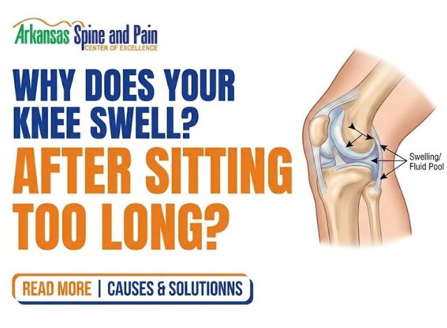 Why Does Your Knee Swell After Sitting Too Long? Causes