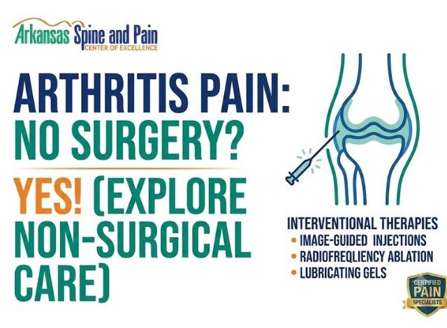 Can Arthritis Pain Be Treated Without Surgery? Non-Surgical Guide