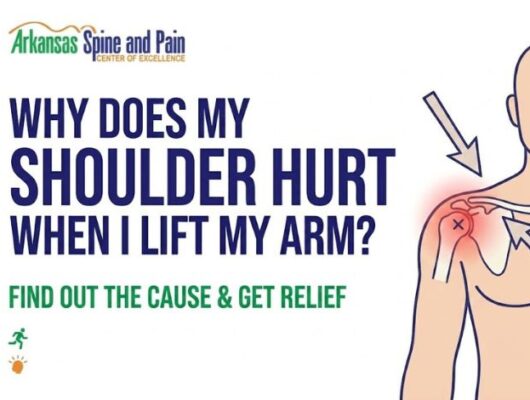 Discover the primary causes of overhead shoulder pain, including impingement and tears. Learn about non-surgical treatments and expert care options.
