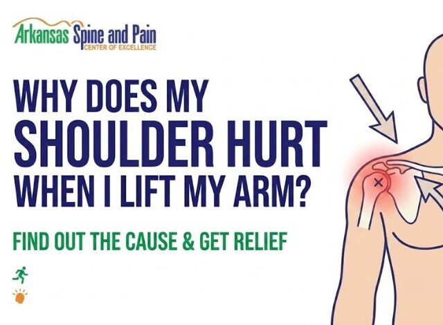 Discover the primary causes of overhead shoulder pain, including impingement and tears. Learn about non-surgical treatments and expert care options.
