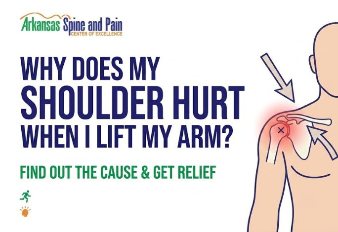 Discover the primary causes of overhead shoulder pain, including impingement and tears. Learn about non-surgical treatments and expert care options.