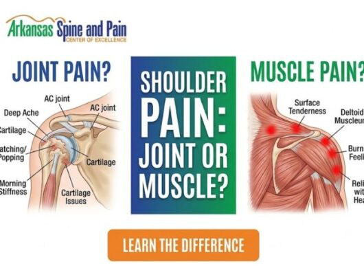 Learn how to tell if your shoulder pain is coming from the joint socket or muscle tissue. Discover key symptoms, causes, and expert non-surgical treatments.
