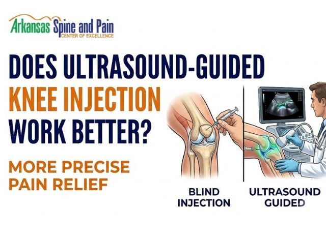 Does Ultrasound-Guided Knee Injection Work Better? Accuracy Guide