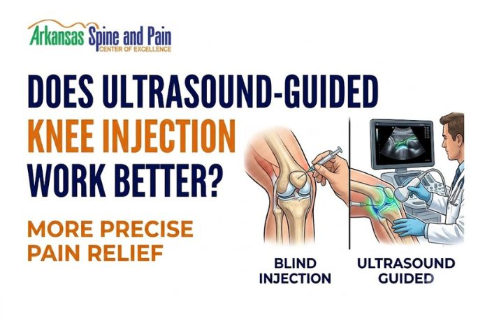 Does Ultrasound-Guided Knee Injection Work Better? Accuracy Guide