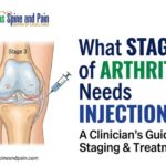 What Stage of Arthritis Needs Injections? Clinical Guide